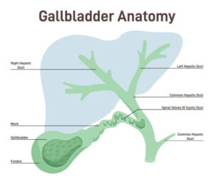 Gallbladder Surgery Malpractice